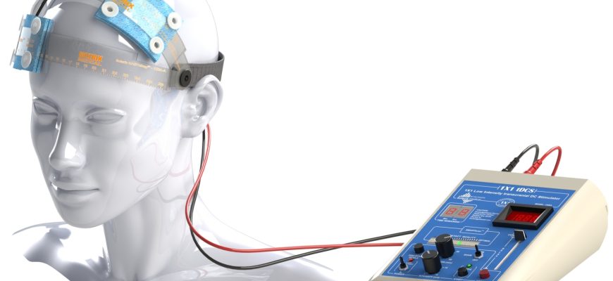 Процедура tDCS в Development Clinic